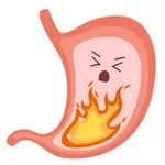 Which Bariatric Surgery - GERD/ Heartburn