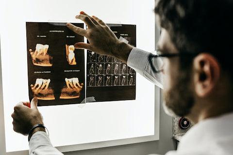 A doctor looking at dental x-rays