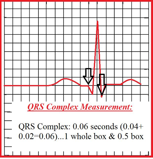 how-to-measure-QRS-complex