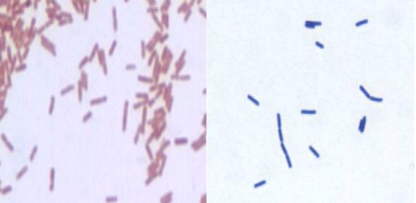 The Gram stain differentiates organisms by the way the react with colored stains: Gram-negative rods (L) stain pink/red; Gram-positive rods (R) stain blue/purple.