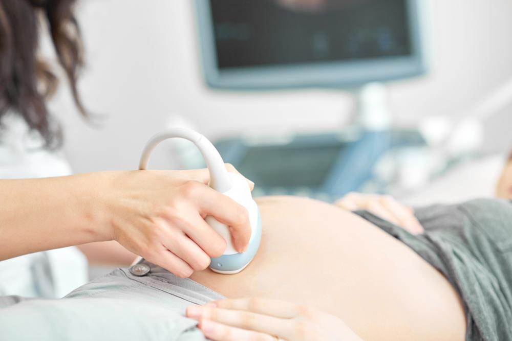 sonographer giving a pregnant woman an ultrasound