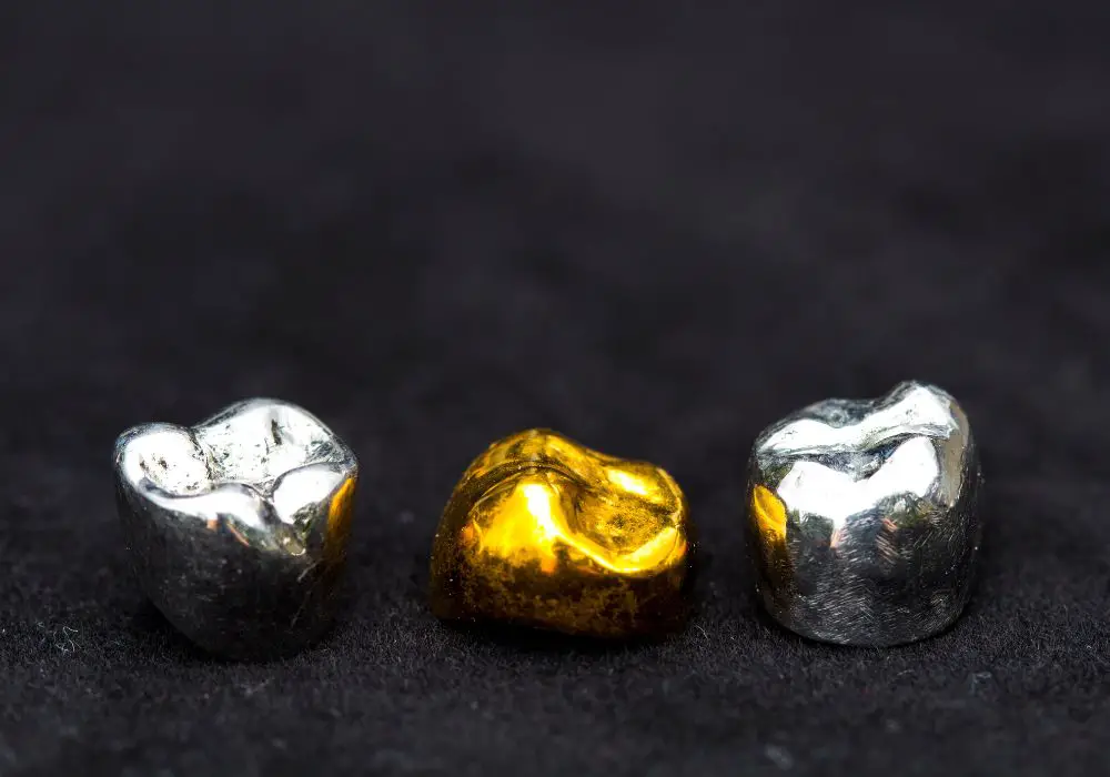 How Much Is Dental Gold Worth