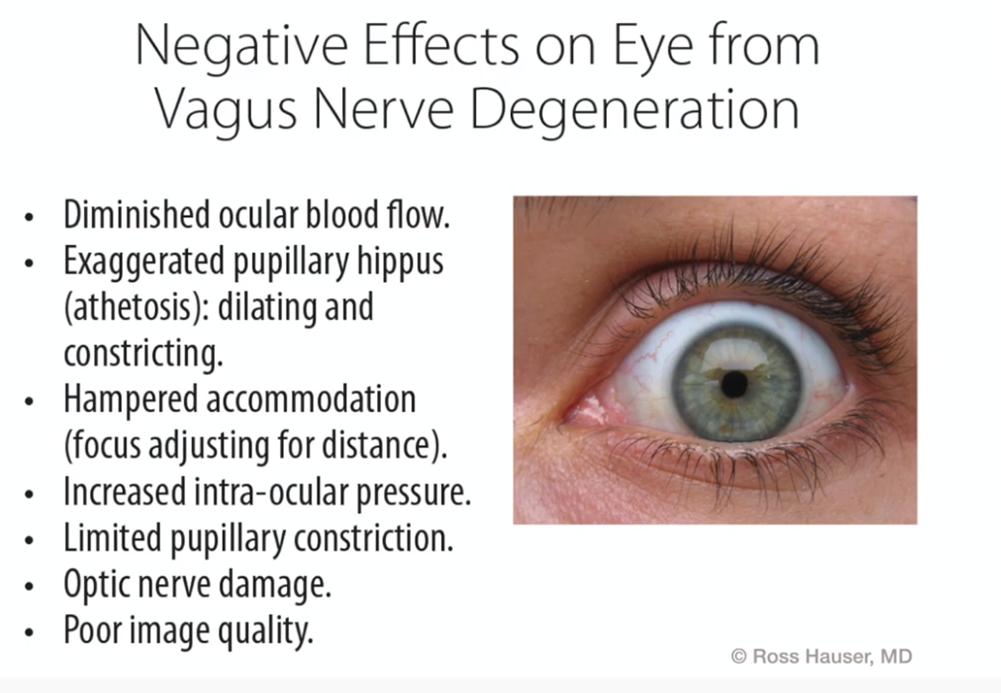 In this image, vision problems caused by cervical spine instability is connected to Diminished ocular blood flow, Exaggerated pupillary hippus dilating, Hampered accommodation or human ocular accommodation mechanism or accommodation reflex, Increased intra-ocular pressure or elevated intraocular pressure, Limited pupillary constriction, Optic nerve damage