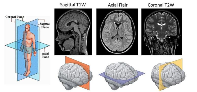 14_mri_mr-coils_-dsc_2326