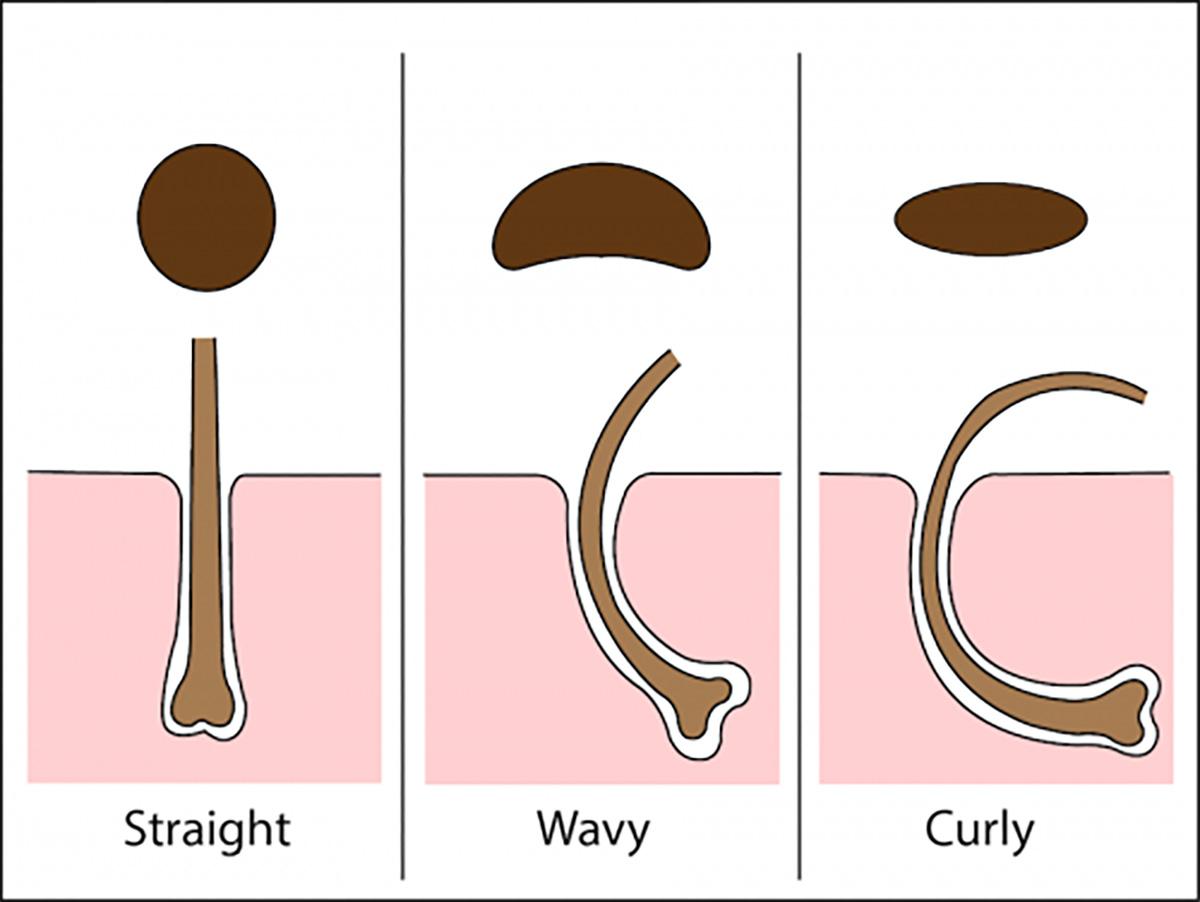 Different shape hair follicles.