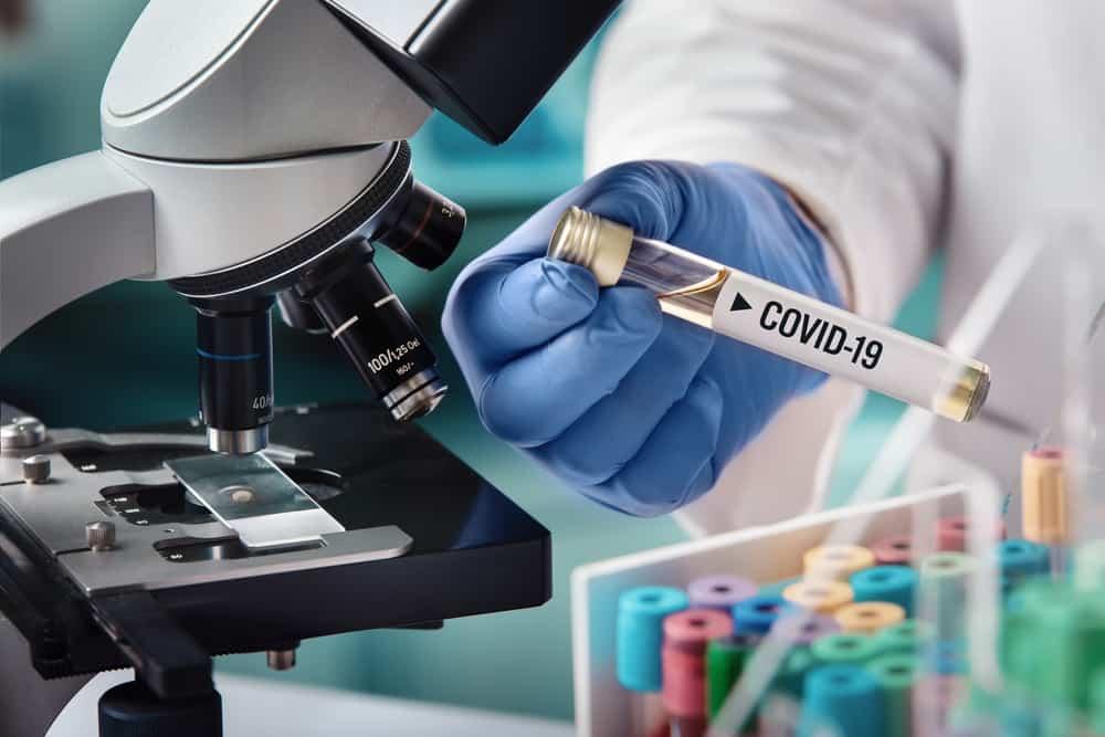 sample contaminated by Coronavirus with label Covid-19