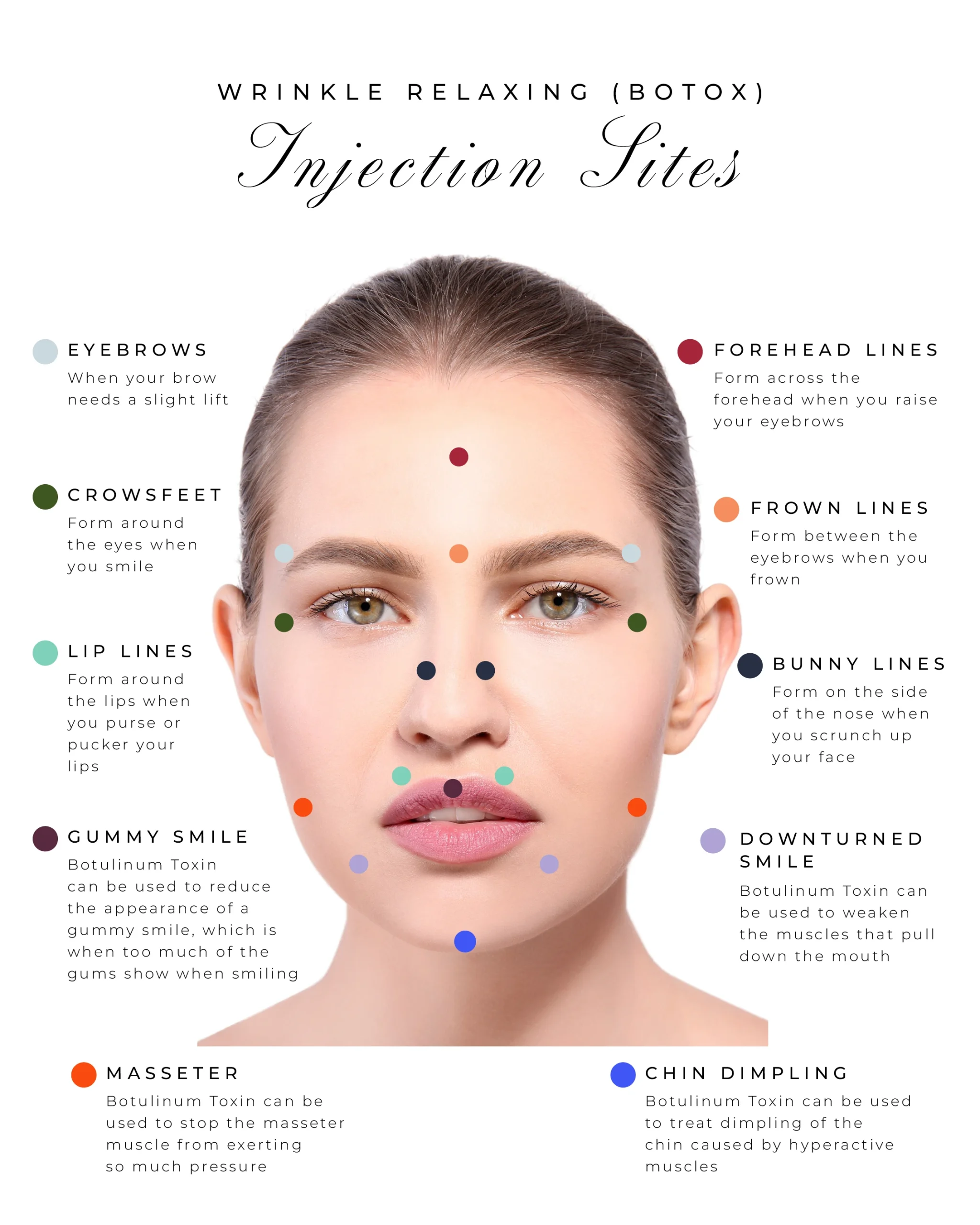 Botox Injection Sites | Aesthetics By Stephanie | Livingston | Bathgate